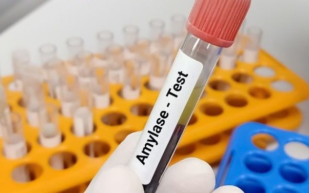 Xét nghiệm amylase - chỉ số amylase 1