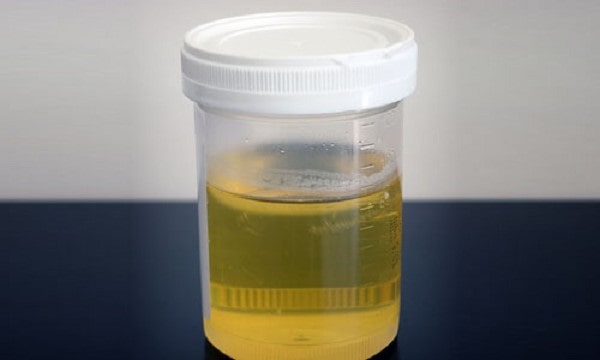 Xét nghiệm amylase - chỉ số amylase 3